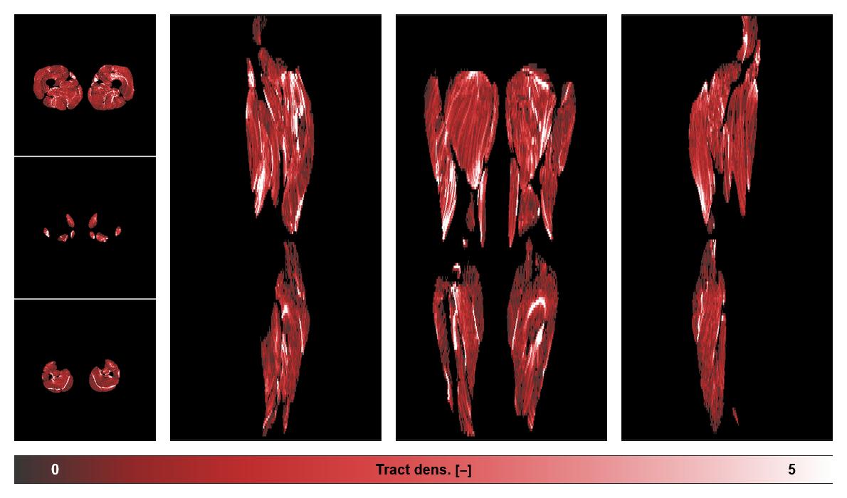 Muscle fiber tract density map based on whole leg DTI based fiber tractography.