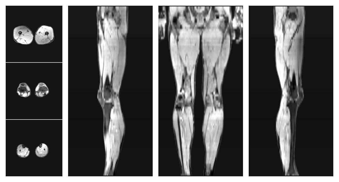 The water part of the acquired multi-echo spin echo data.