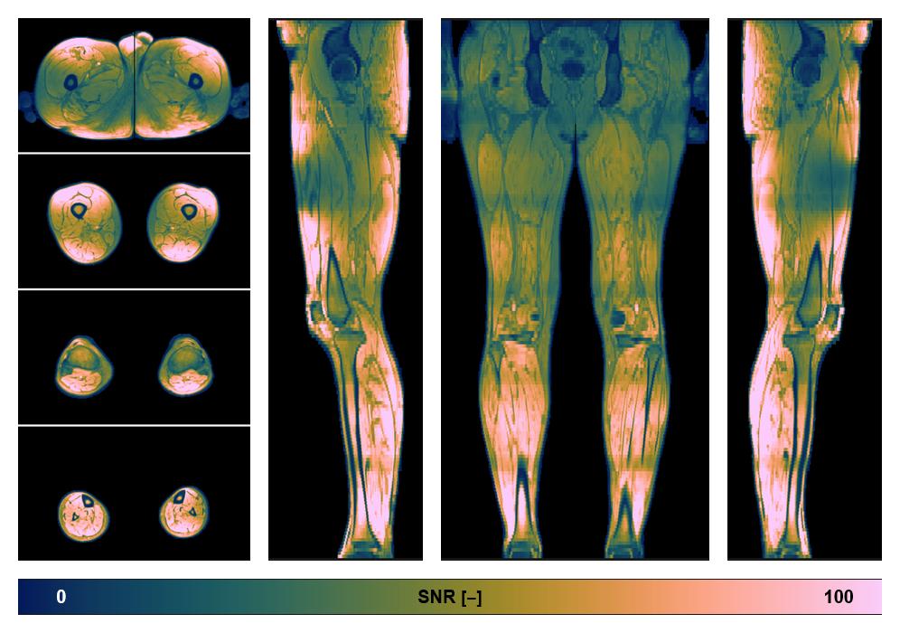 The SNR distribution of the dixon data.