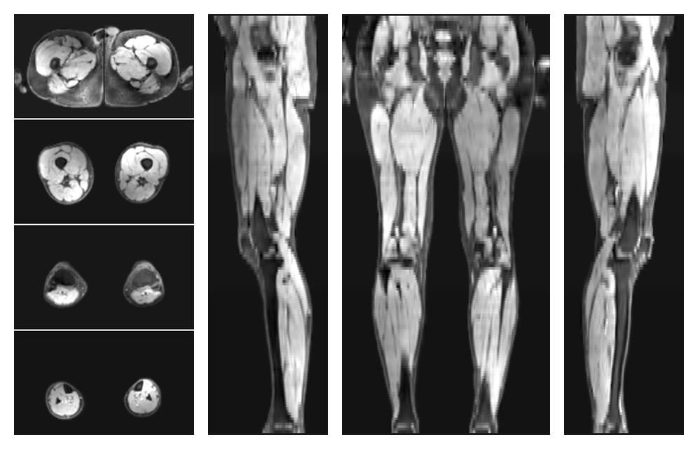 The water part of the acquired multi-echo spin echo data.