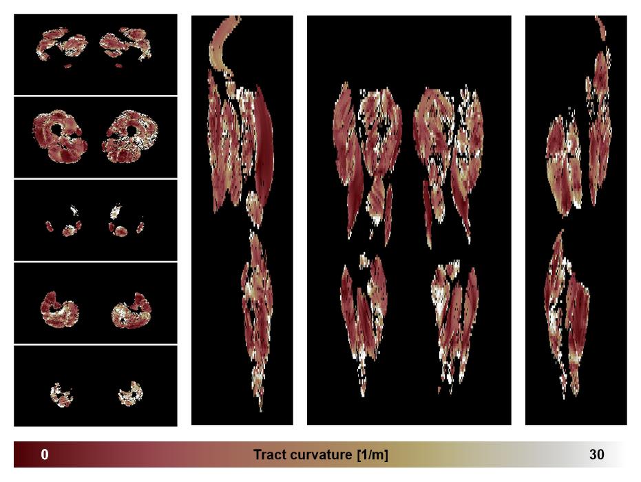 Muscle fiber tract curvature map based on whole leg DTI based fiber tractography.