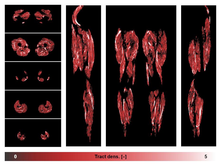 Muscle fiber tract density map based on whole leg DTI based fiber tractography.