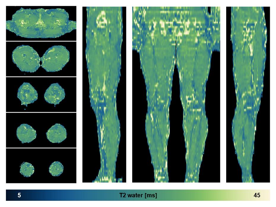 The water only T2 relaxation time of the lower extremity obtained from multi echo spin echo t2 mapping with EPG based reconstruction.