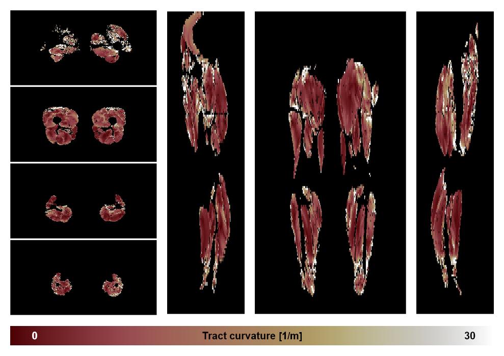 Muscle fiber tract curvature map based on whole leg DTI based fiber tractography.