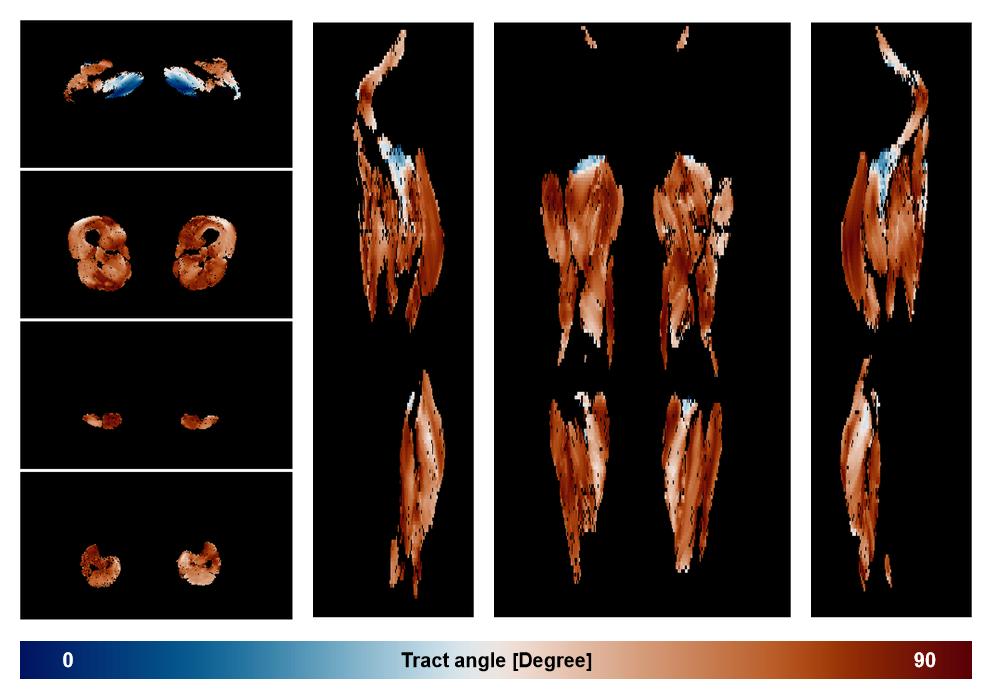 Muscle fiber tract angle map based on whole leg DTI based fiber tractography.