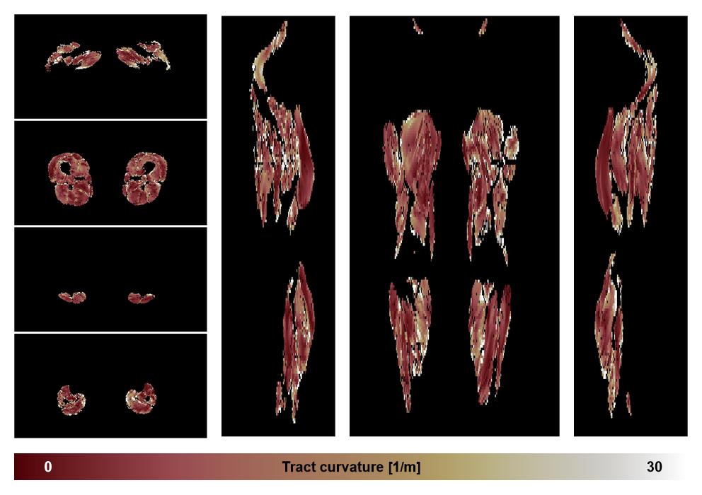 Muscle fiber tract curvature map based on whole leg DTI based fiber tractography.