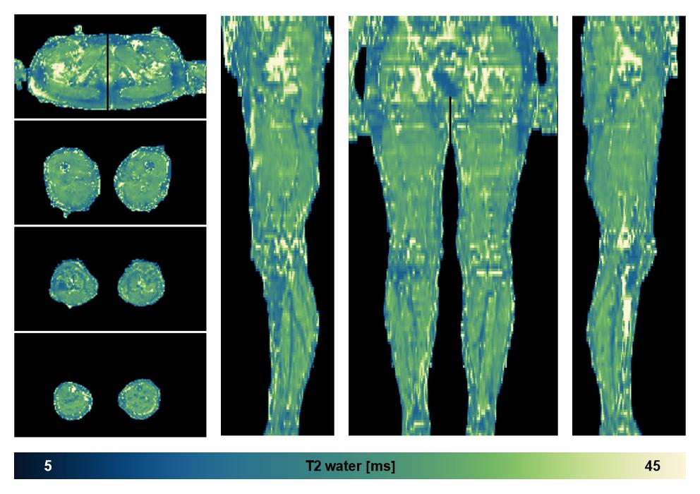 The water only T2 relaxation time of the lower extremity obtained from multi echo spin echo t2 mapping with EPG based reconstruction.