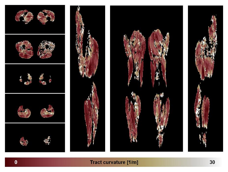 Muscle fiber tract curvature map based on whole leg DTI based fiber tractography.