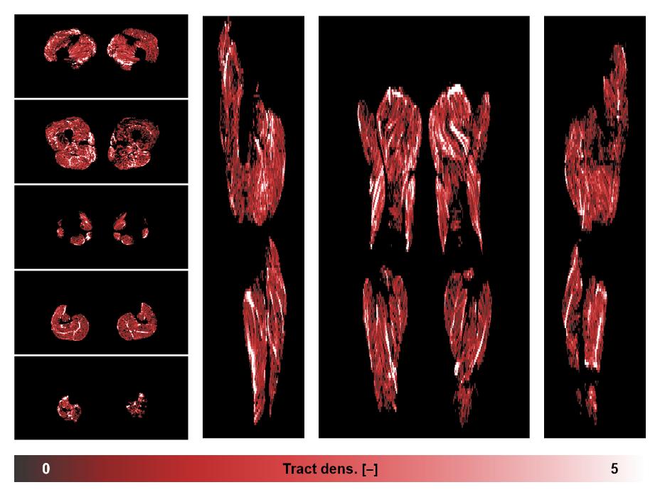 Muscle fiber tract density map based on whole leg DTI based fiber tractography.
