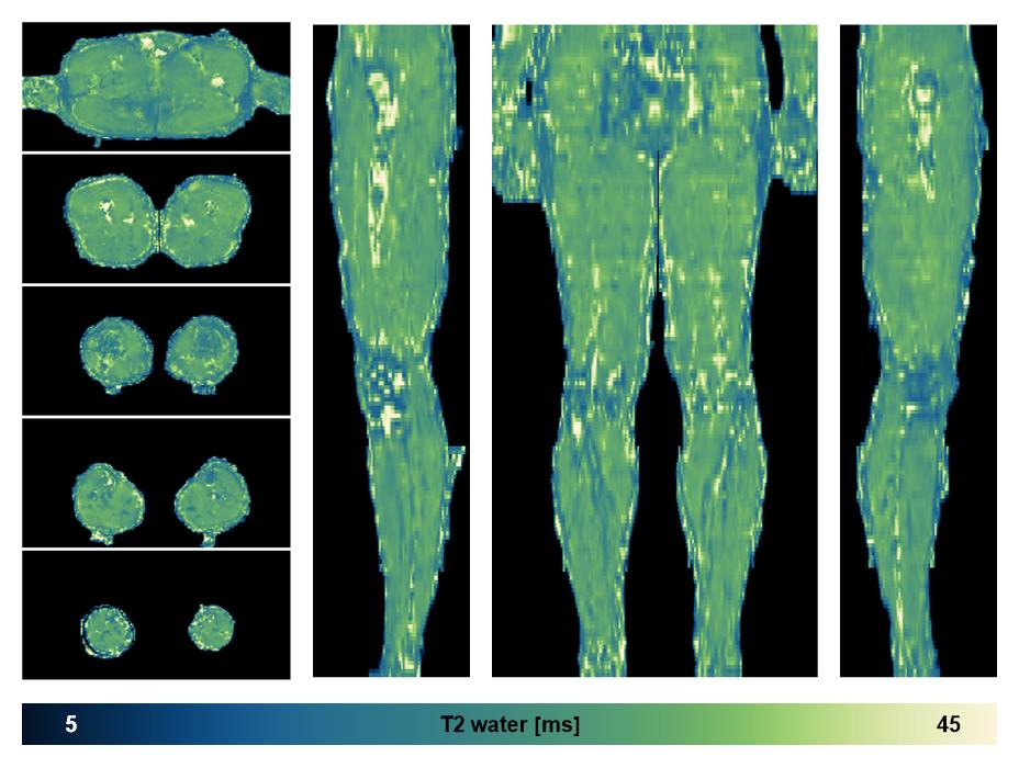 The water only T2 relaxation time of the lower extremity obtained from multi echo spin echo t2 mapping with EPG based reconstruction.