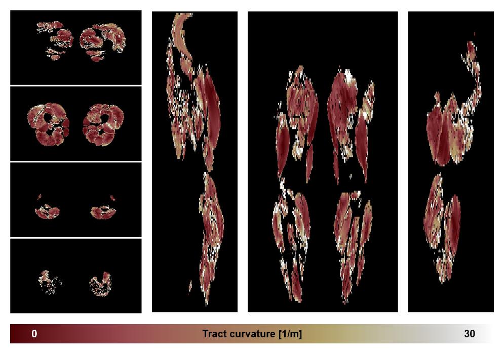 Muscle fiber tract curvature map based on whole leg DTI based fiber tractography.