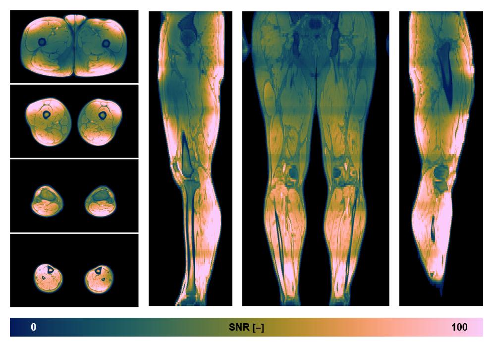The SNR distribution of the dixon data.