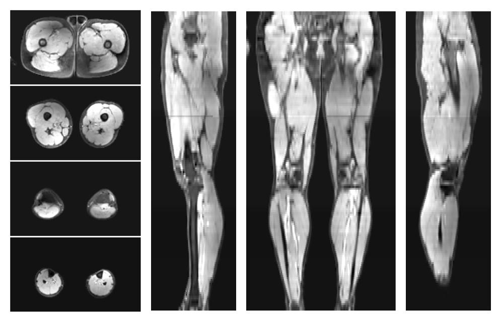 The water part of the acquired multi-echo spin echo data.