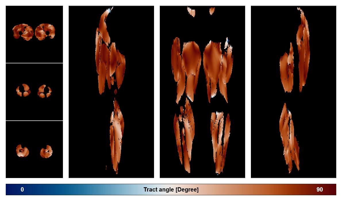 Muscle fiber tract angle map based on whole leg DTI based fiber tractography.
