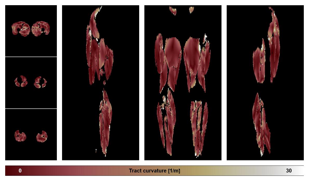 Muscle fiber tract curvature map based on whole leg DTI based fiber tractography.