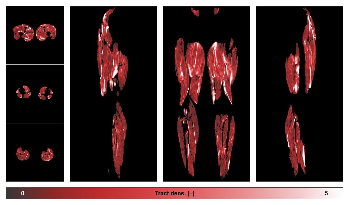 Muscle fiber tract density map based on whole leg DTI based fiber tractography.