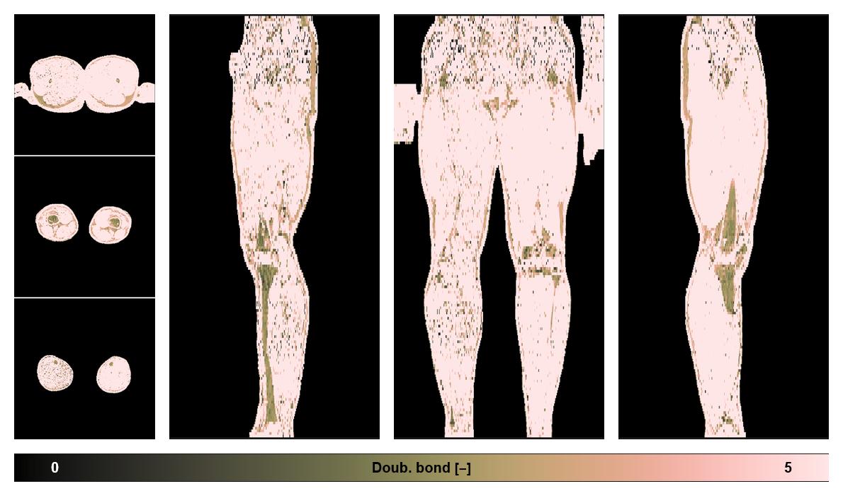 Number of double bonds in subcutanious fat.