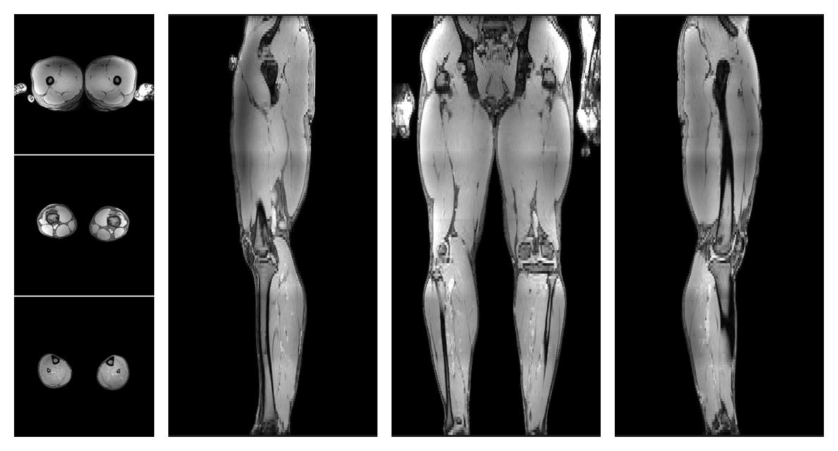 The out-phase image of the dixon reconstruction for water fat quantification.