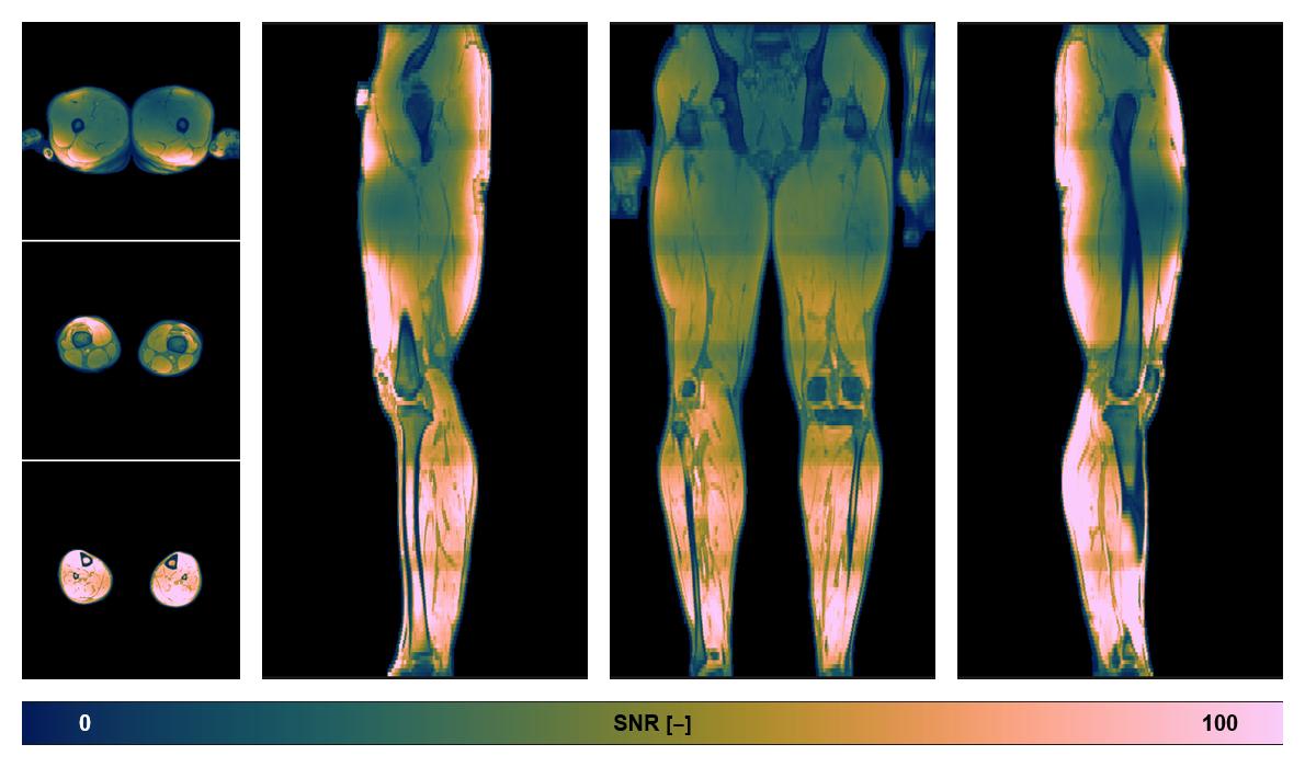 The SNR distribution of the dixon data.