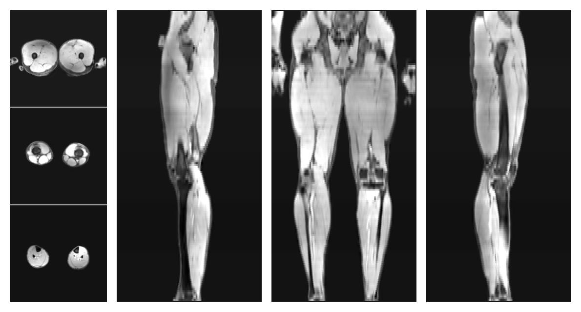 The water part of the acquired multi-echo spin echo data.