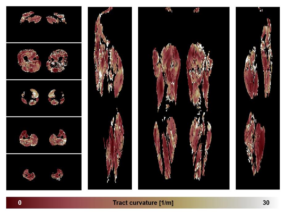 Muscle fiber tract curvature map based on whole leg DTI based fiber tractography.