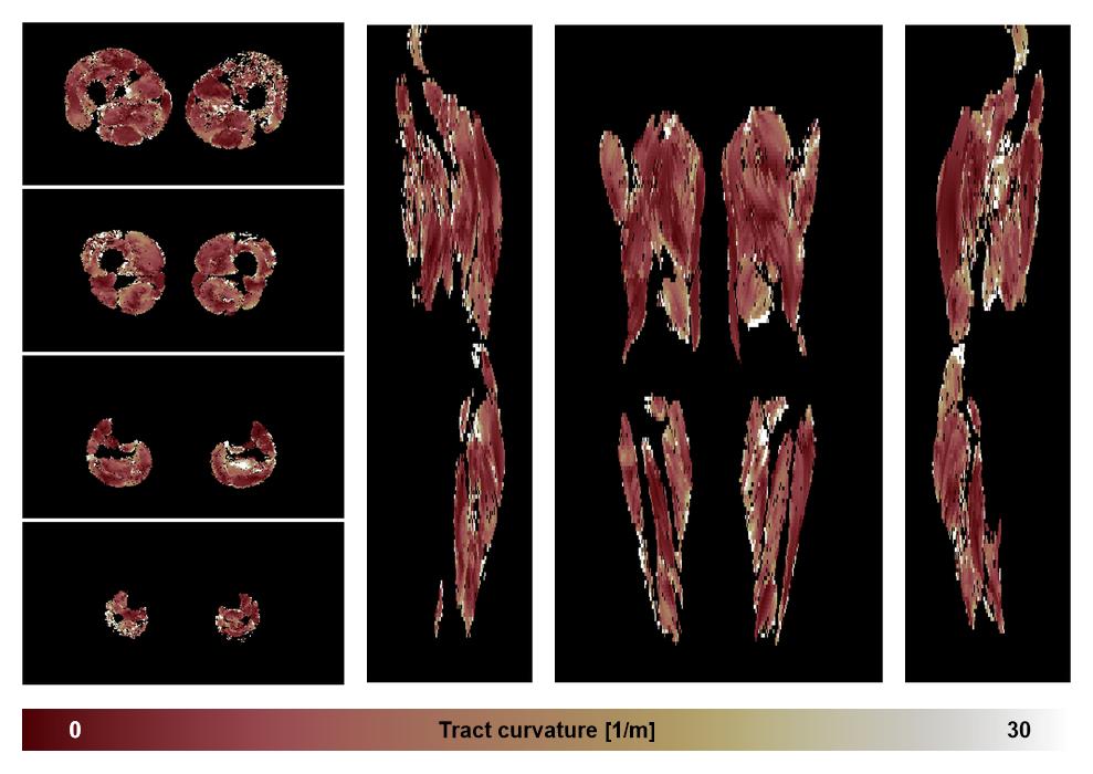 Muscle fiber tract curvature map based on whole leg DTI based fiber tractography.