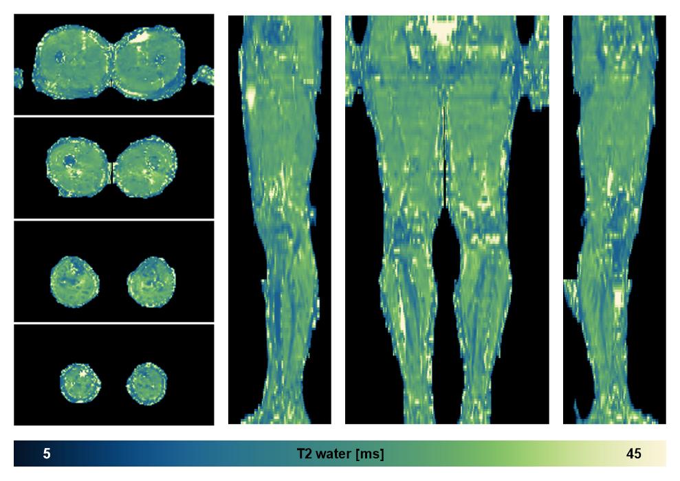 The water only T2 relaxation time of the lower extremity obtained from multi echo spin echo t2 mapping with EPG based reconstruction.