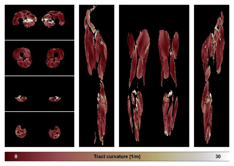 Muscle fiber tract curvature map based on whole leg DTI based fiber tractography.