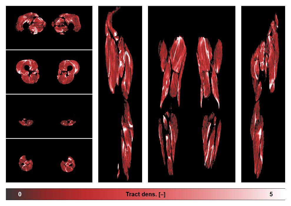 Muscle fiber tract density map based on whole leg DTI based fiber tractography.