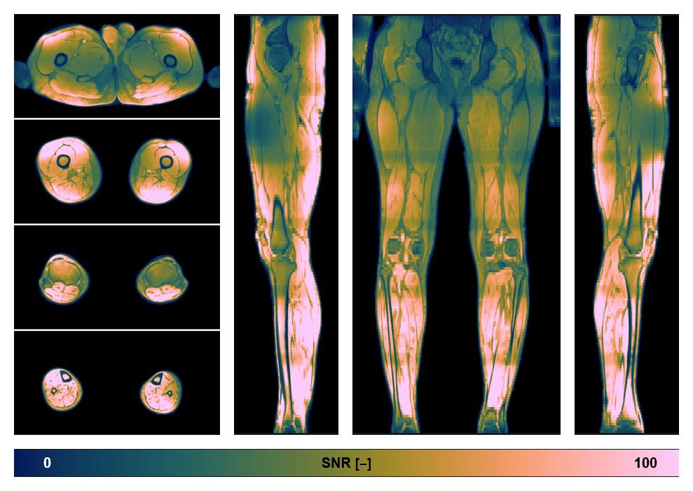 The SNR distribution of the dixon data.