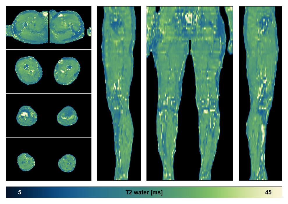 The water only T2 relaxation time of the lower extremity obtained from multi echo spin echo t2 mapping with EPG based reconstruction.