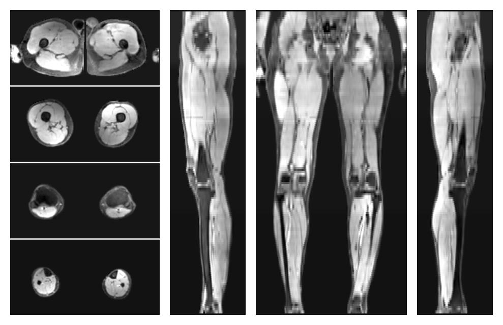 The water part of the acquired multi-echo spin echo data.