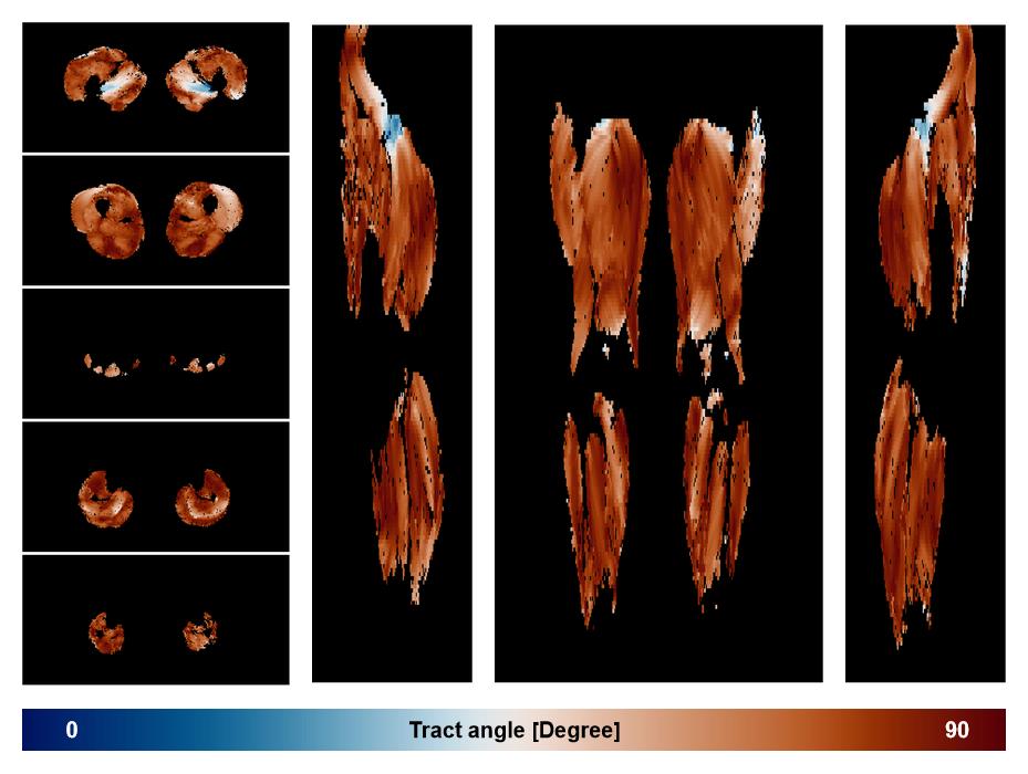 Muscle fiber tract angle map based on whole leg DTI based fiber tractography.