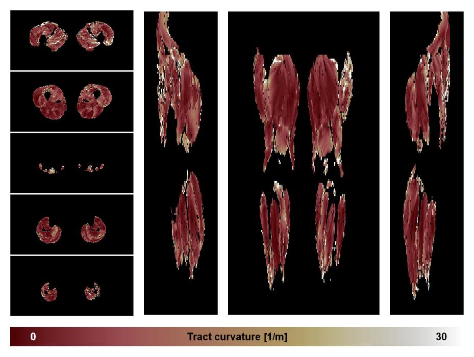 Muscle fiber tract curvature map based on whole leg DTI based fiber tractography.