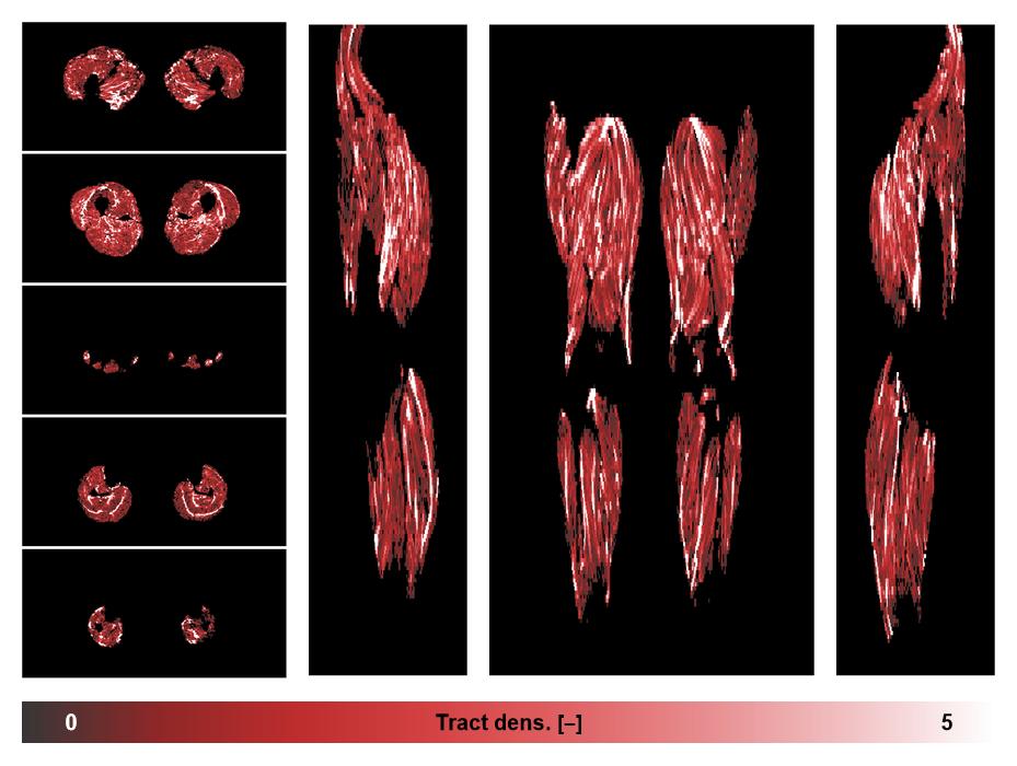 Muscle fiber tract density map based on whole leg DTI based fiber tractography.