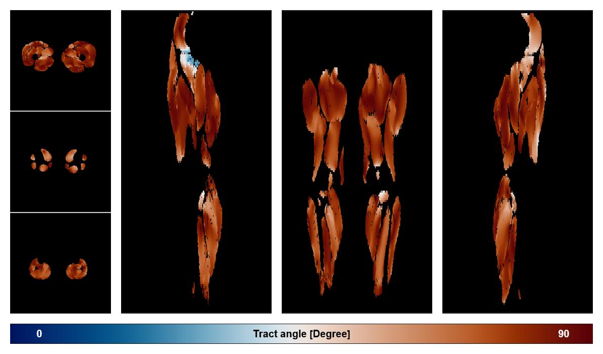 Muscle fiber tract angle map based on whole leg DTI based fiber tractography.