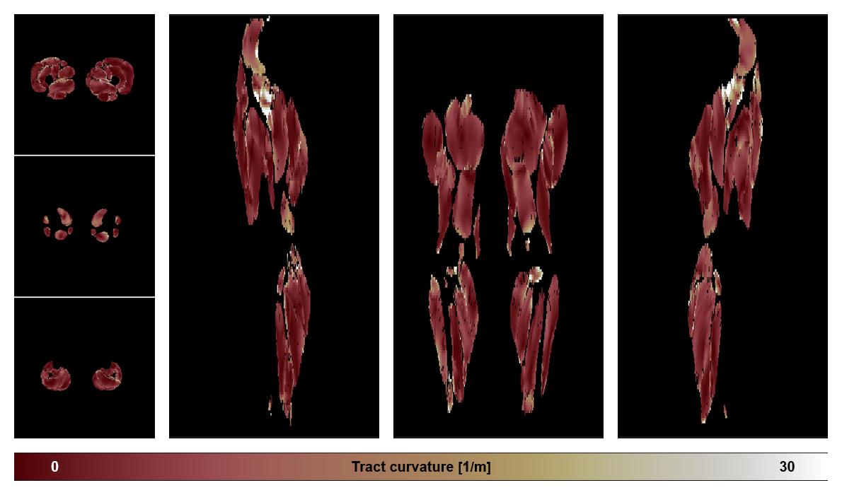 Muscle fiber tract curvature map based on whole leg DTI based fiber tractography.