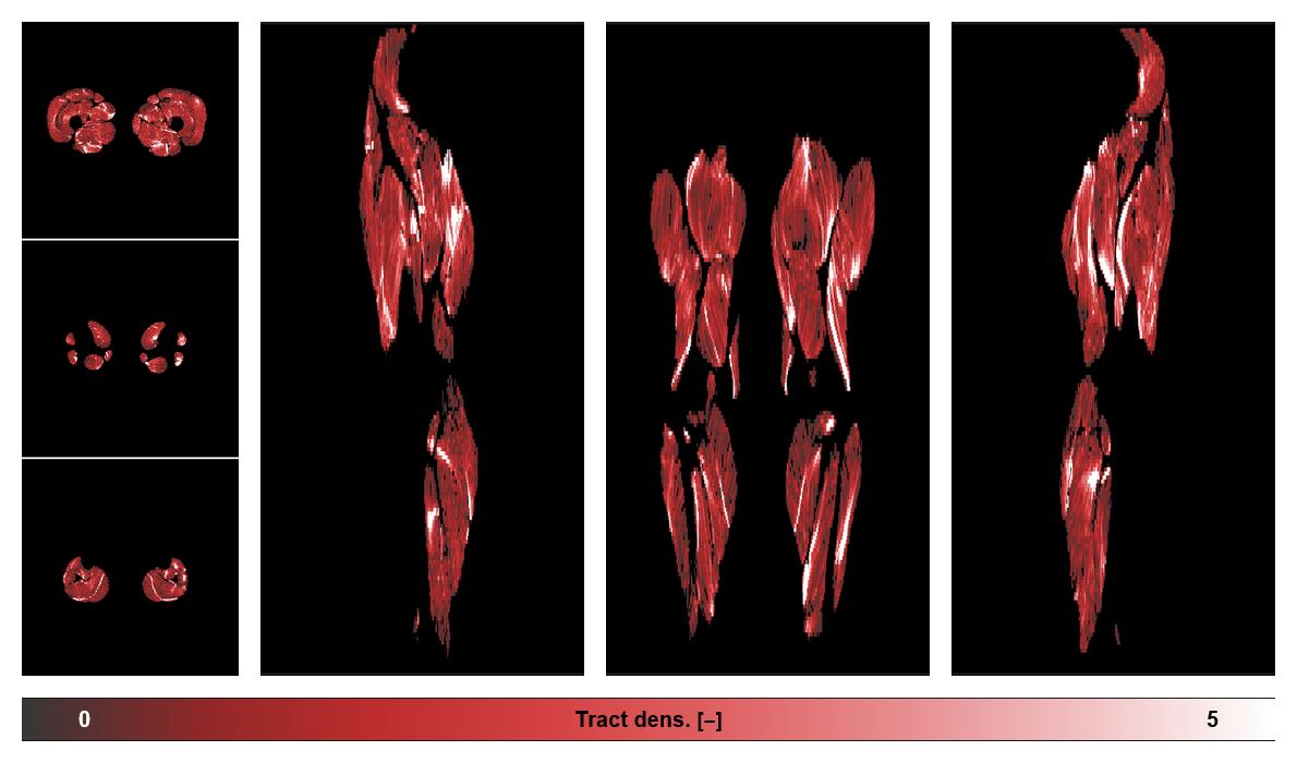 Muscle fiber tract density map based on whole leg DTI based fiber tractography.