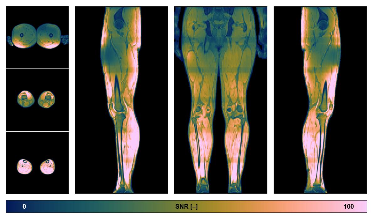 The SNR distribution of the dixon data.
