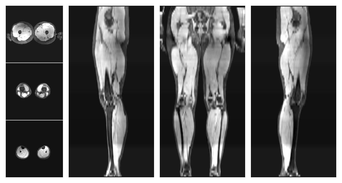 The water part of the acquired multi-echo spin echo data.