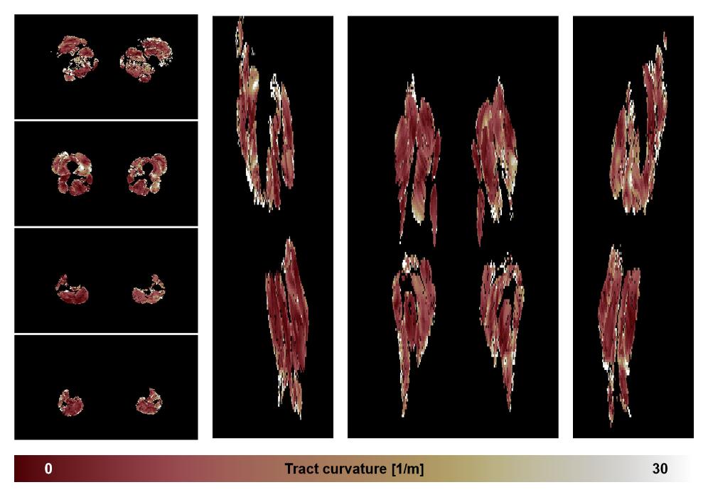 Muscle fiber tract curvature map based on whole leg DTI based fiber tractography.