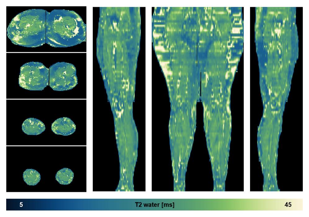 The water only T2 relaxation time of the lower extremity obtained from multi echo spin echo t2 mapping with EPG based reconstruction.