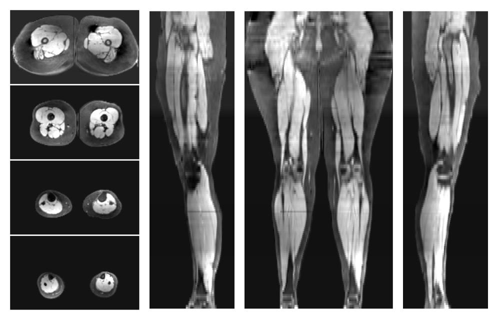 The water part of the acquired multi-echo spin echo data.