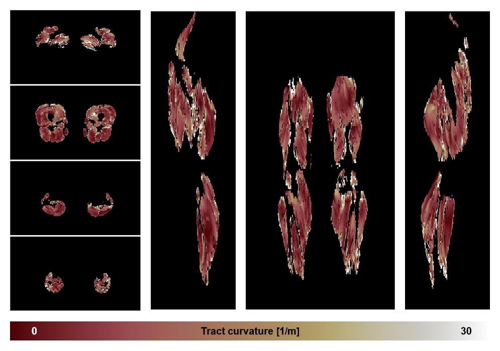 Muscle fiber tract curvature map based on whole leg DTI based fiber tractography.