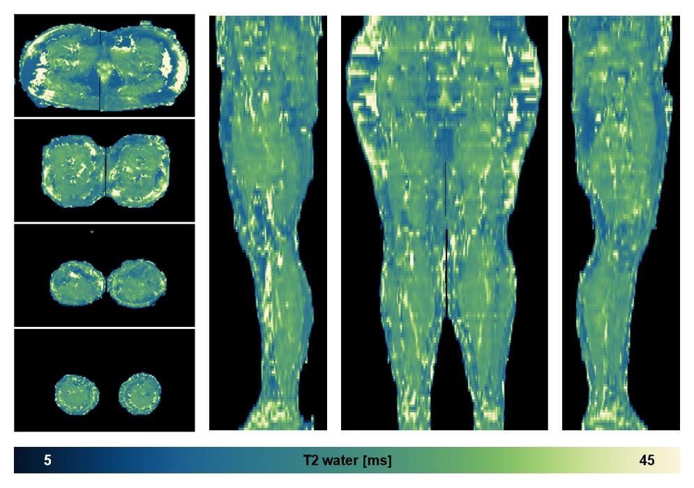 The water only T2 relaxation time of the lower extremity obtained from multi echo spin echo t2 mapping with EPG based reconstruction.