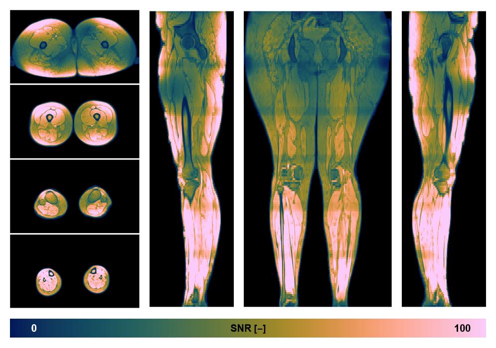 The SNR distribution of the dixon data.