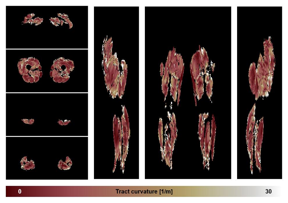 Muscle fiber tract curvature map based on whole leg DTI based fiber tractography.