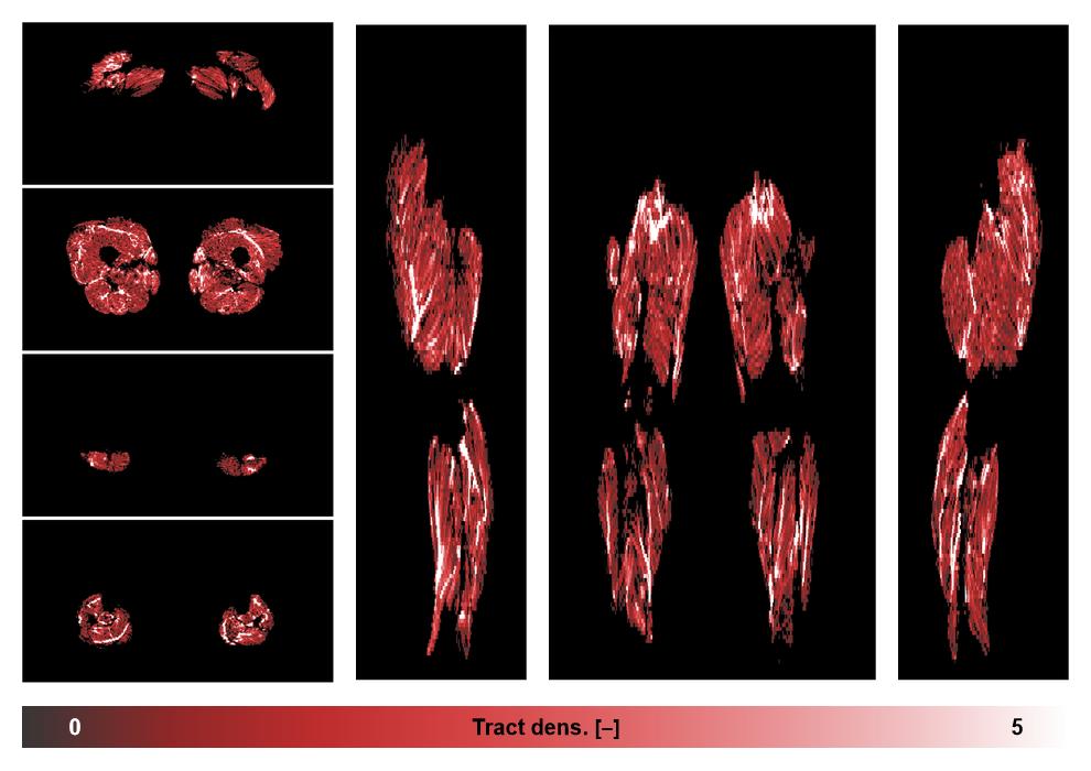 Muscle fiber tract density map based on whole leg DTI based fiber tractography.