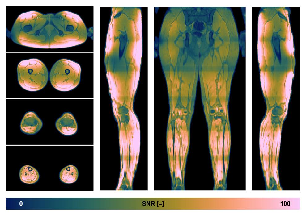 The SNR distribution of the dixon data.
