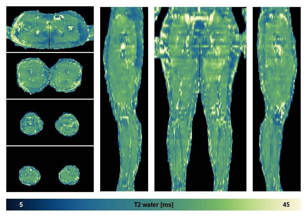 The water only T2 relaxation time of the lower extremity obtained from multi echo spin echo t2 mapping with EPG based reconstruction.